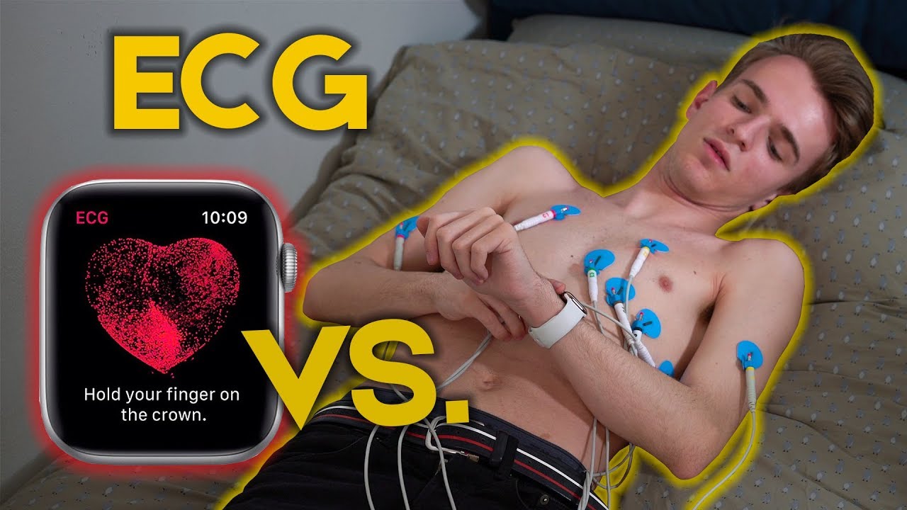 ELETTROCARDIOGRAMMA DI APPLE WATCH VS. STANDARD [feat. MIO PADRE]