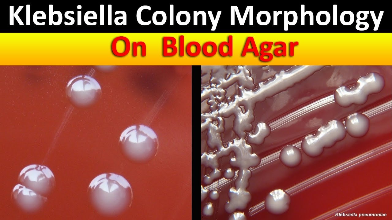 Klebsiella Colony Morphology  On Blood Agar