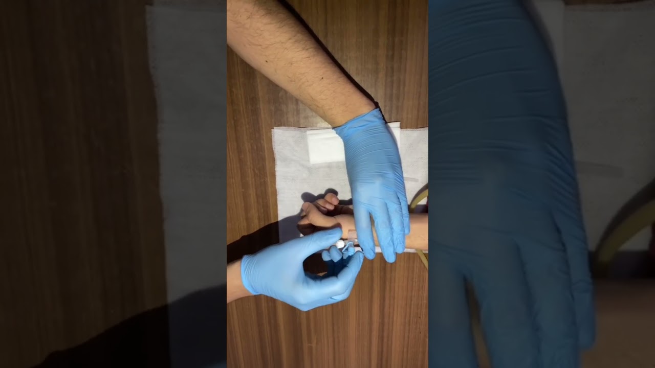 Venaga Angiokateter Cannula o'rnatish.Катетеризация периферическойвены/peripheral venous cannulation