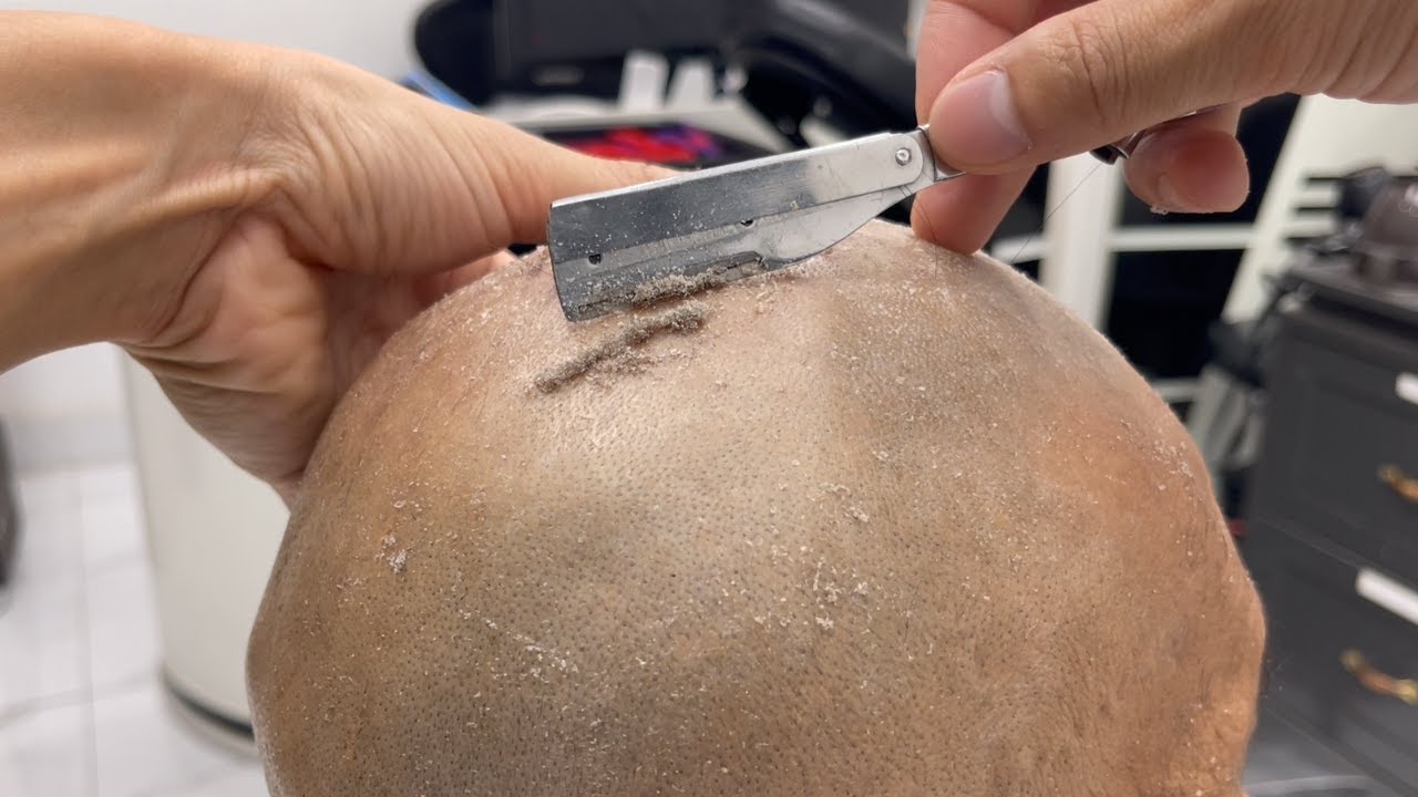 ASMR 👨🏽‍🦲 FOR A GOOD SLEEP 😱 REMOVES A LOT OF DEAD SKIN FROM THE MAN'S HEAD | SHAVING ASMR EP492