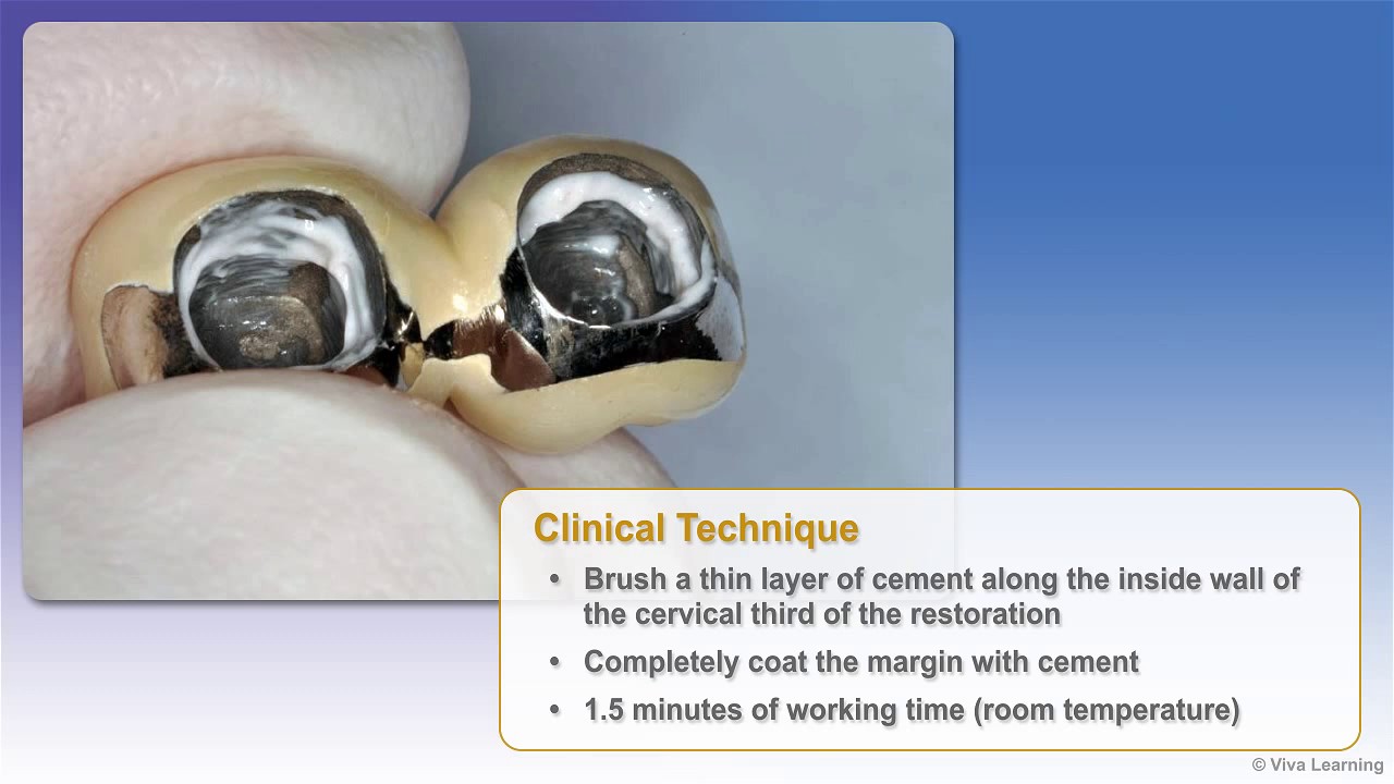 Premier Implant Cement