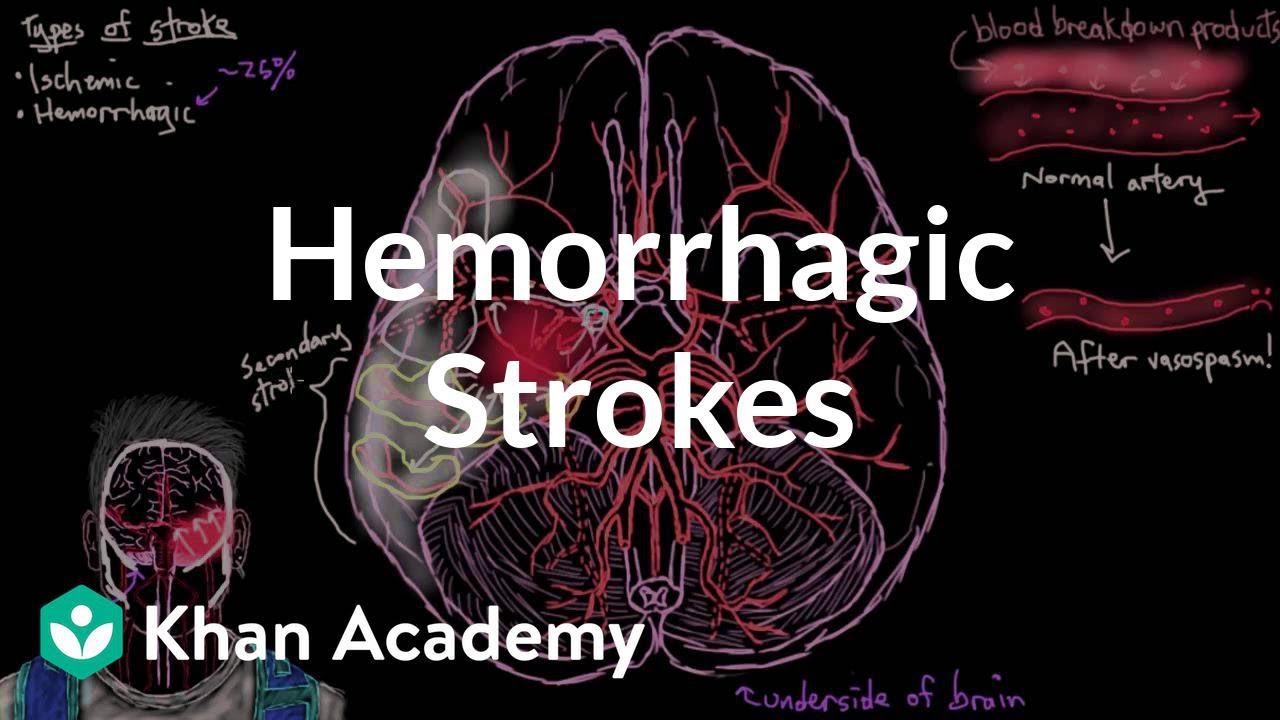 Hemorrhagic strokes | Circulatory System and Disease | NCLEX-RN | Khan Academy
