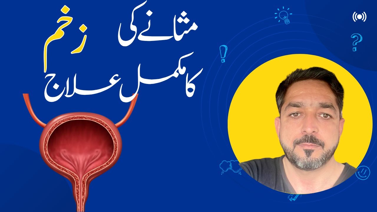 Urinary tract infection | مثانے کی زخم کا مکمل علاج|UTI Treatment by Dr Farid Gul