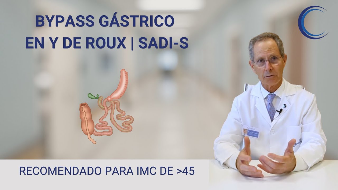 Webinar- Bypass Gástrico y Tipo SADI-S