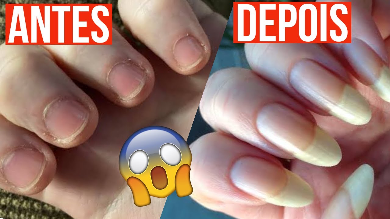 Unhas Grandes em 3 Dias | receita com apenas 2 ingredientes