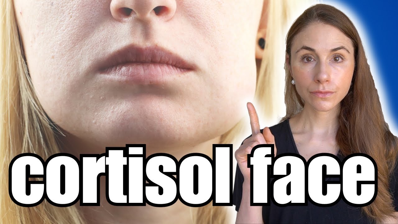 Do You Suffer From Cortisol Face?