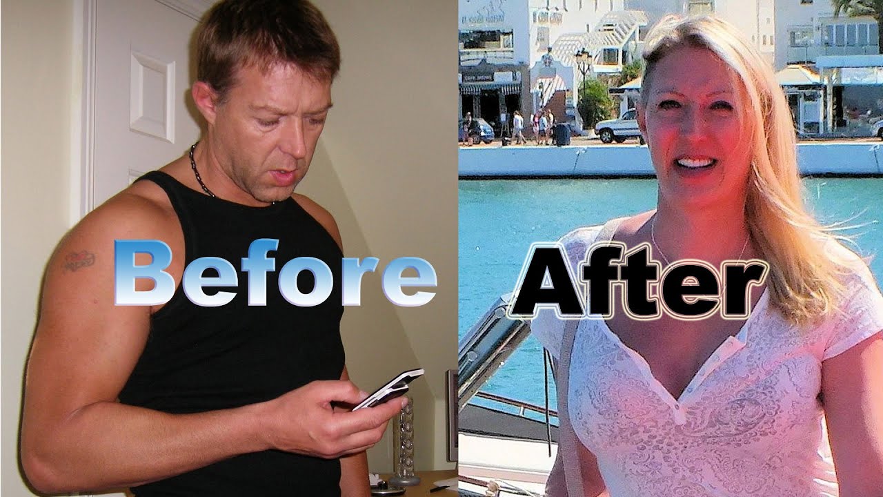 She was once a 6.2 foot strong man and is now a beautiful woman | Emma's FFS Journey