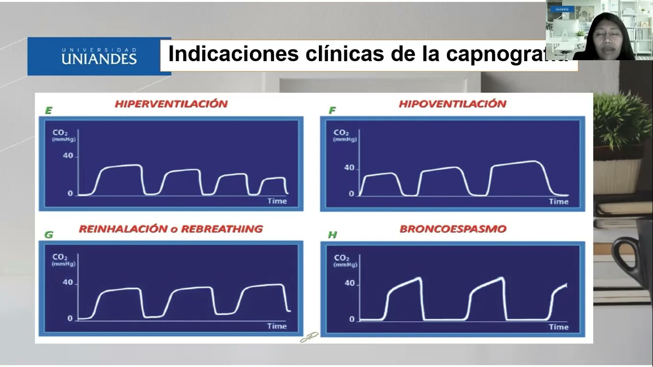 CAPNOGRAFÍA  JASMIN CUASPUD