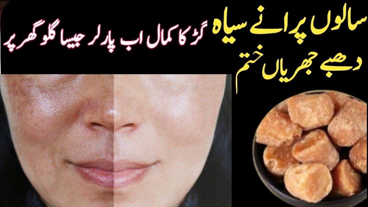 Homemade 0 Cost Skin Whitening Mask | Just One Apply All Skin Problem's Will be Gone Farever