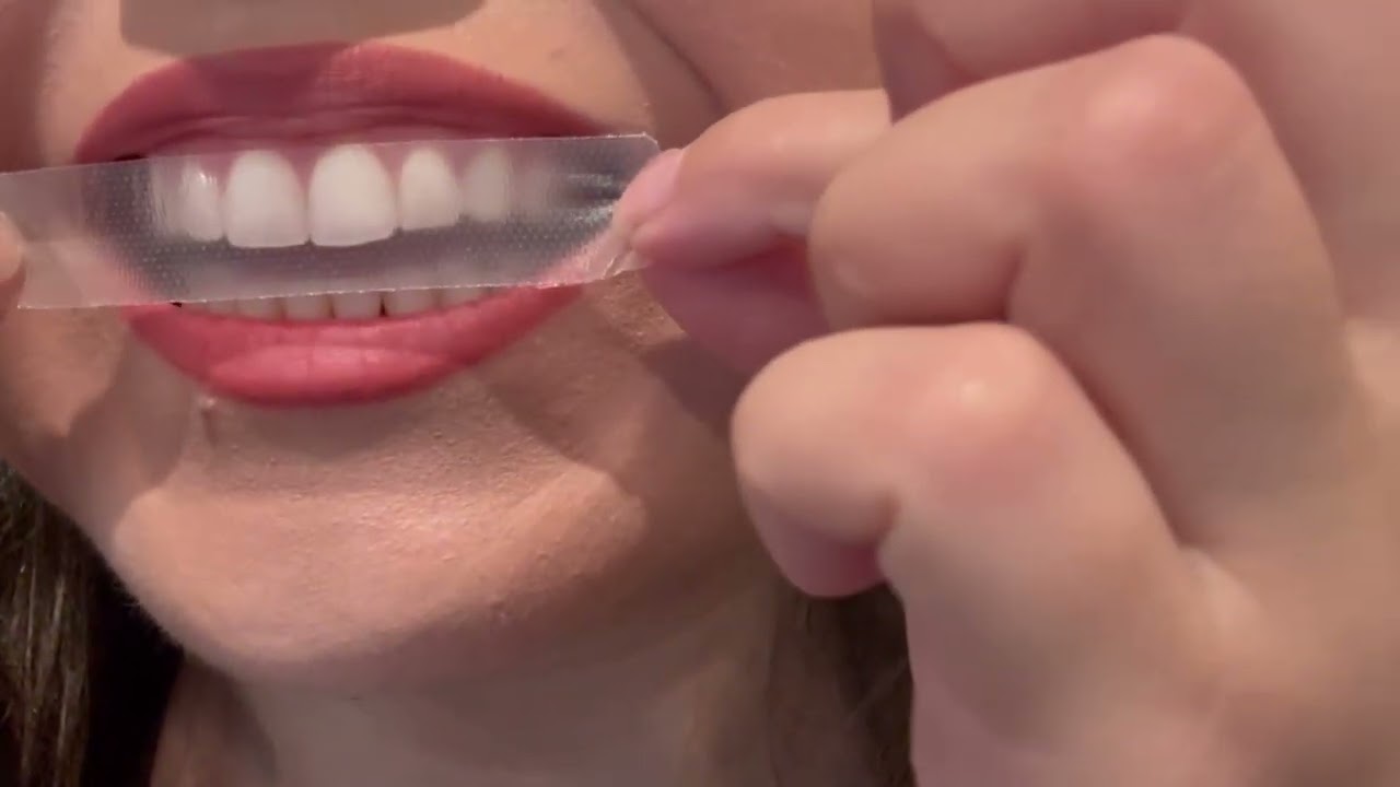 Crest 3D Whitestrips Professional Bright Levels 12 Teeth Whitening Kit Review