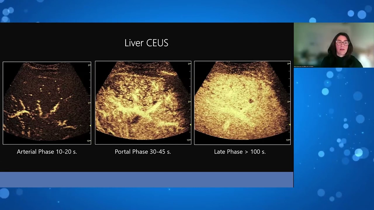 Integrating Contrast  Enhanced Ultrasound CEUS into daily practice for sonographers