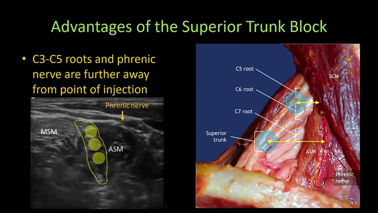 Advantages of the SUPERIOR TRUNK BLOCK