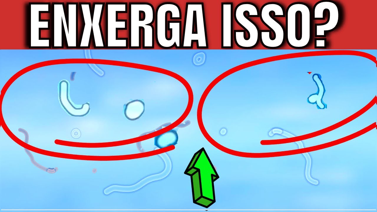 Por que você enxerga SUJEIRINHAS flutuando nos olhos? | Como ACABAR com elas (naturalmente)?