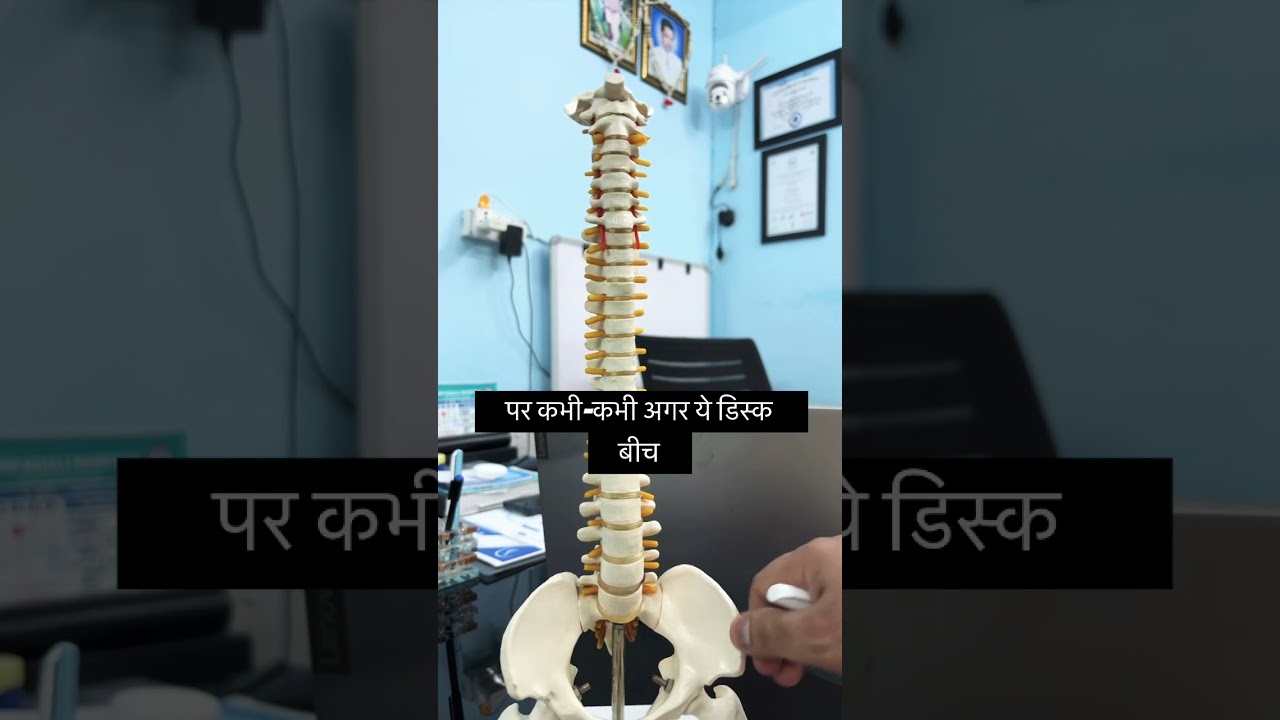 Disc Protrusion Physiotherapy Tips 
