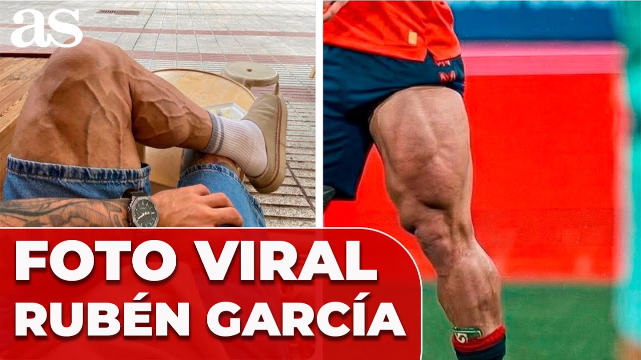 La verdad sobre la FOTO VIRAL de la PIERNA de RUB&Eacute;N GARC&Iacute;A
