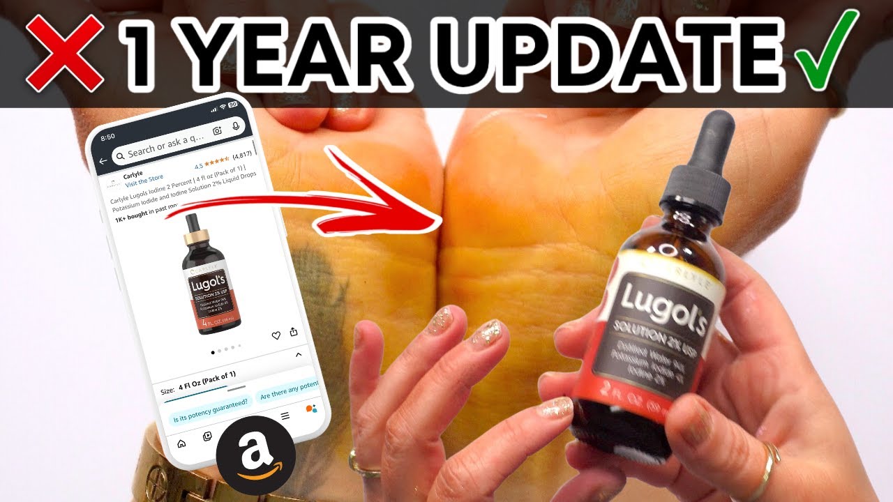 LUGOLS IODINE DROPS | 1 Year Later