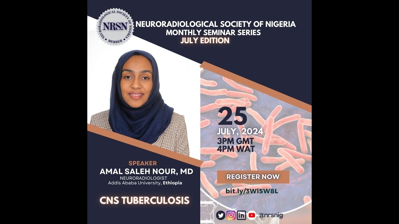 Dr. Amal Saleh Nour | CNS Tuberculosis | July 2024