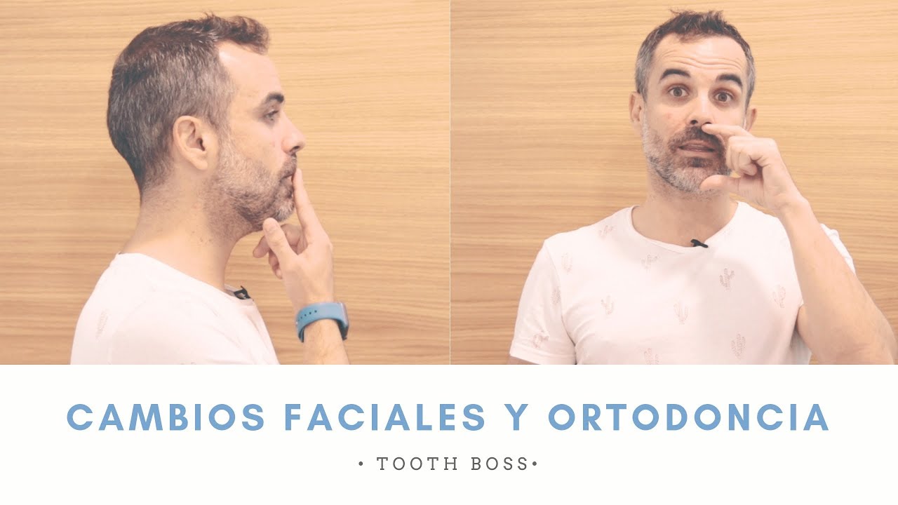 TOOTH BOSS || ¿La ORTODONCIA puede cambiarme la CARA? 😱|| Ortodoncia en Murcia