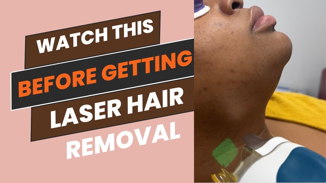 Laser hair removal  Guide| FAQs during a consultation |Black skincare