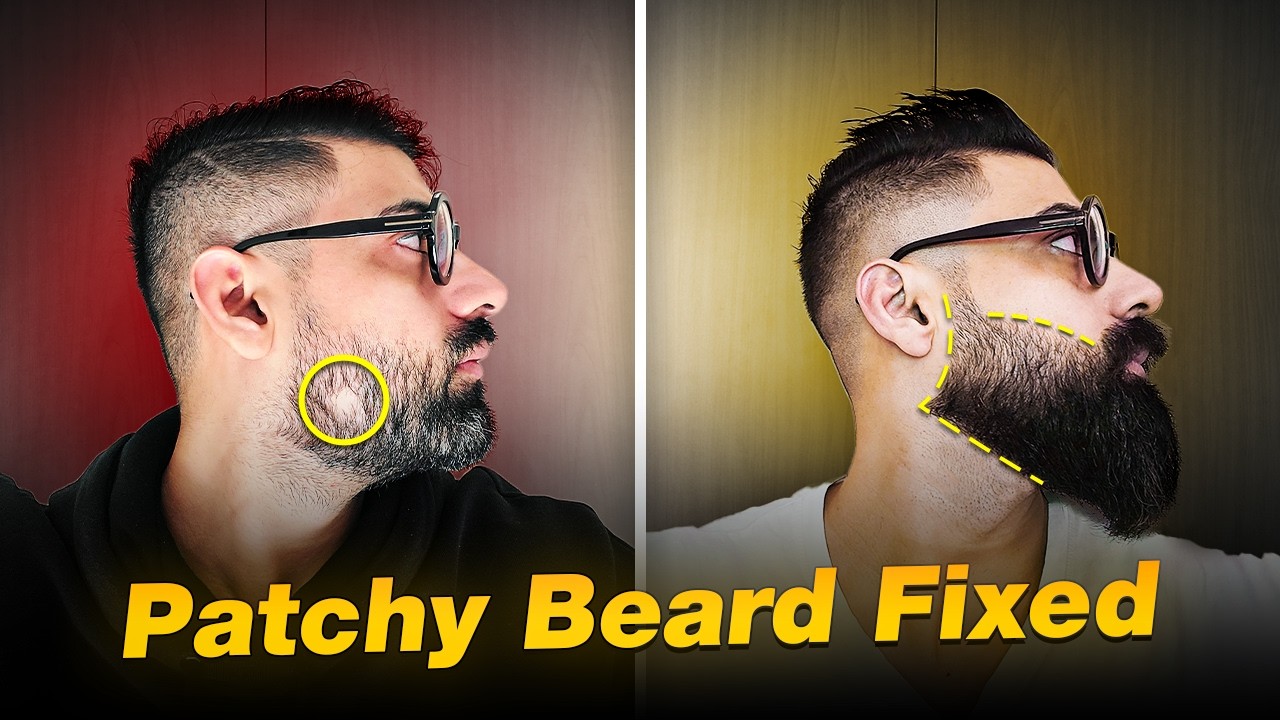 How to fix a patchy beard? Perfect Solution for Beard Growth REVEALED | Beard Growth Formula