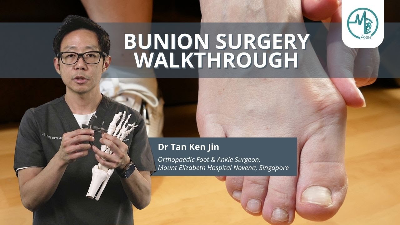 Orthopaedic Surgeon Explains Bunion Surgery | Dr Tan Ken Jin (Orthopaedics)