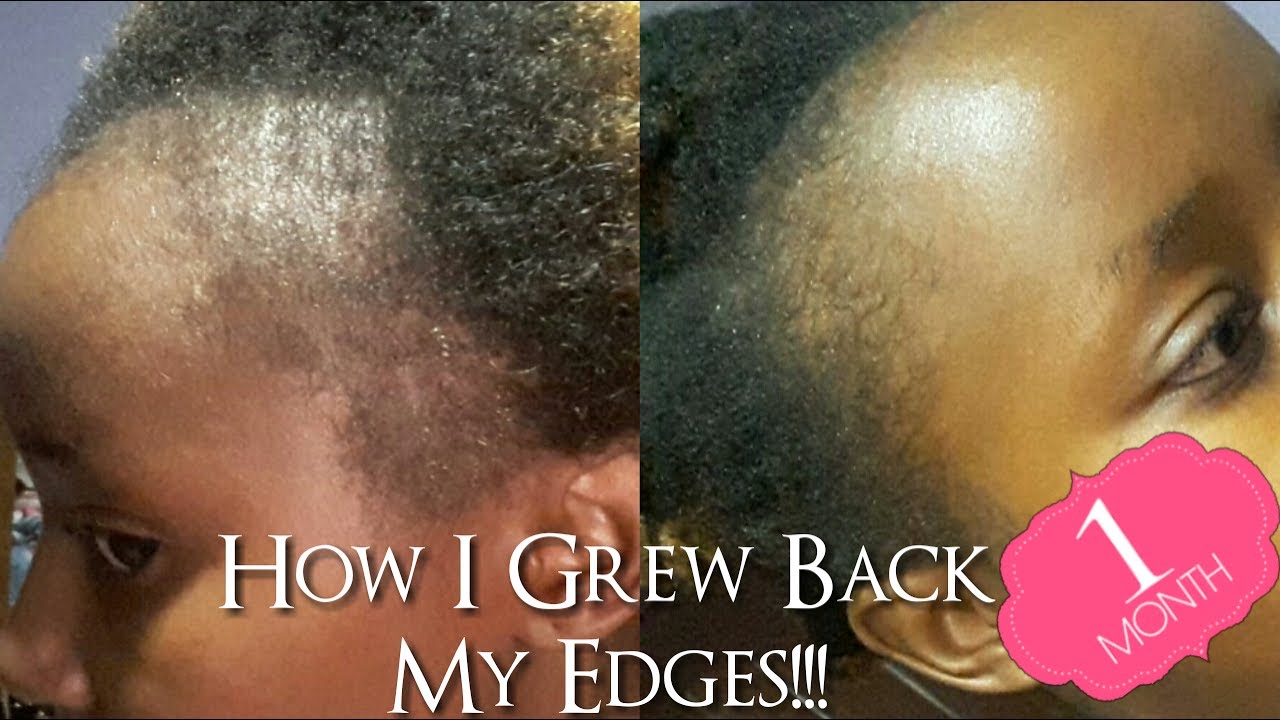 How I Grew Back My Edges // 4 Weeks Progress // Wabosha Maxine