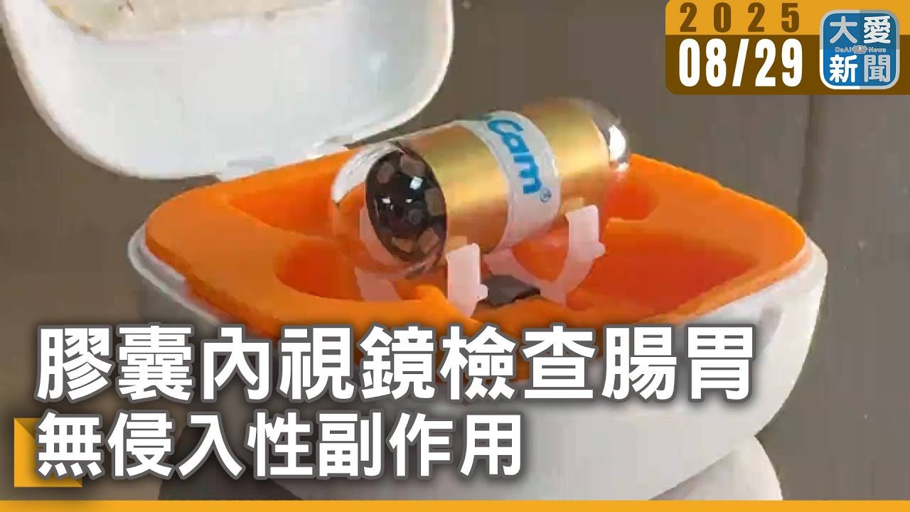膠囊內視鏡檢查腸胃&nbsp;無侵入性副作用｜大愛新聞  @DaaiWorldNews