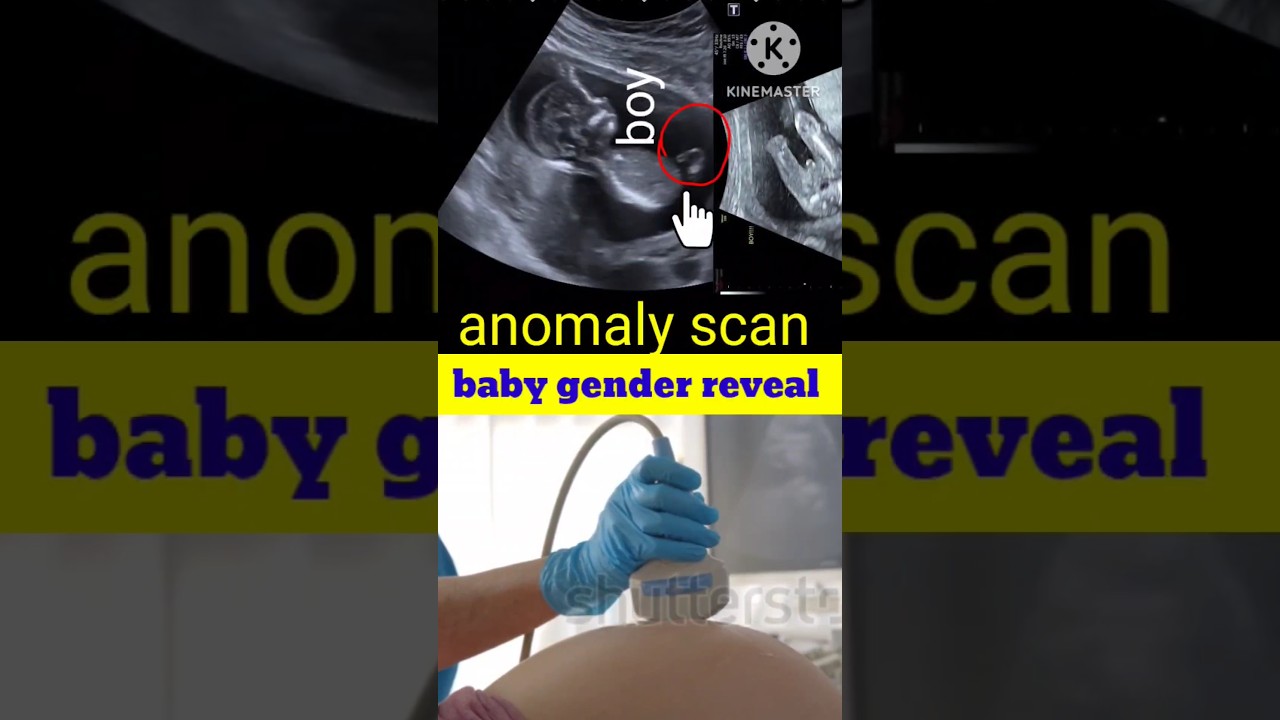 anomaly scan ultrasound। Gender Reveal 