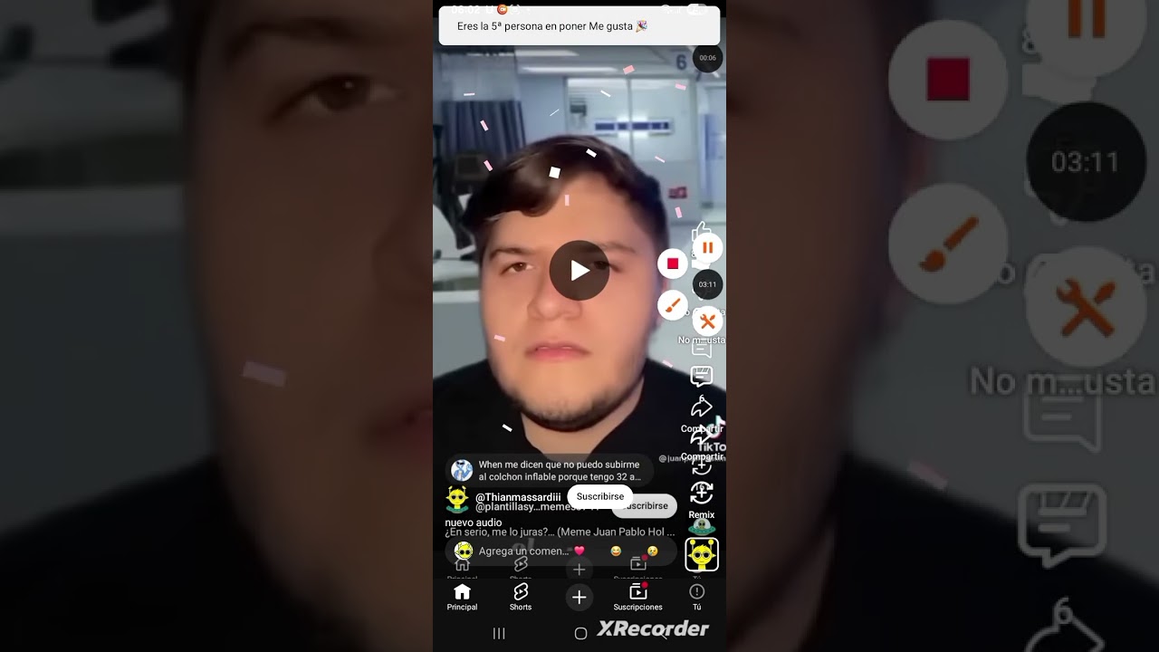 Xd
