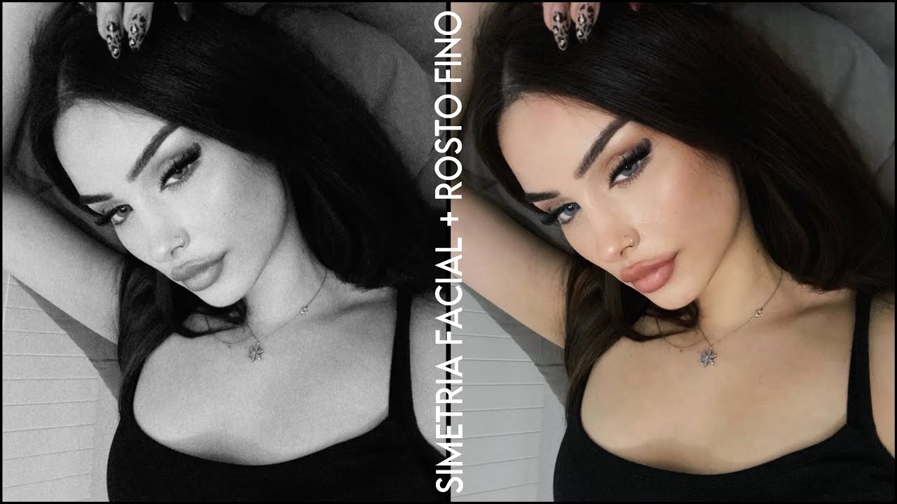 simetria facial + rosto fino ☻