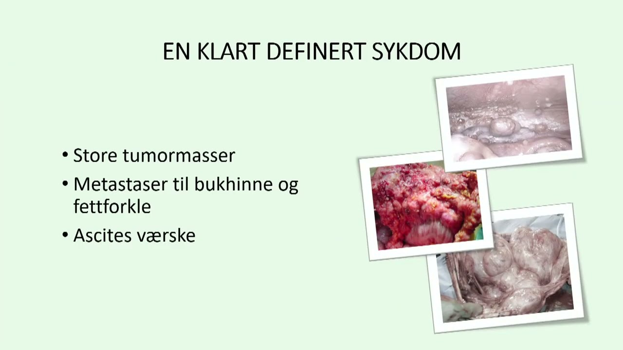 Kunnskapsdag om gynkreft 22.01.25, eggstokkreft ved Bjørge