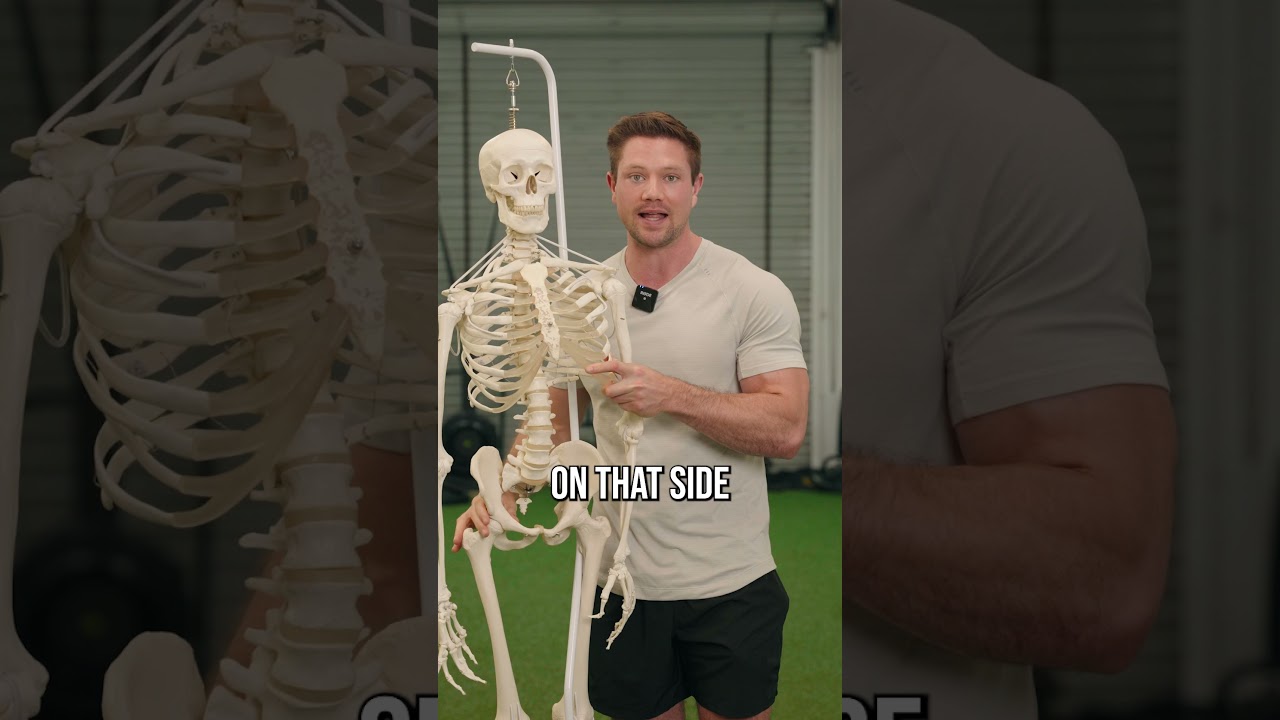How To Fix A Tilted Head Posture