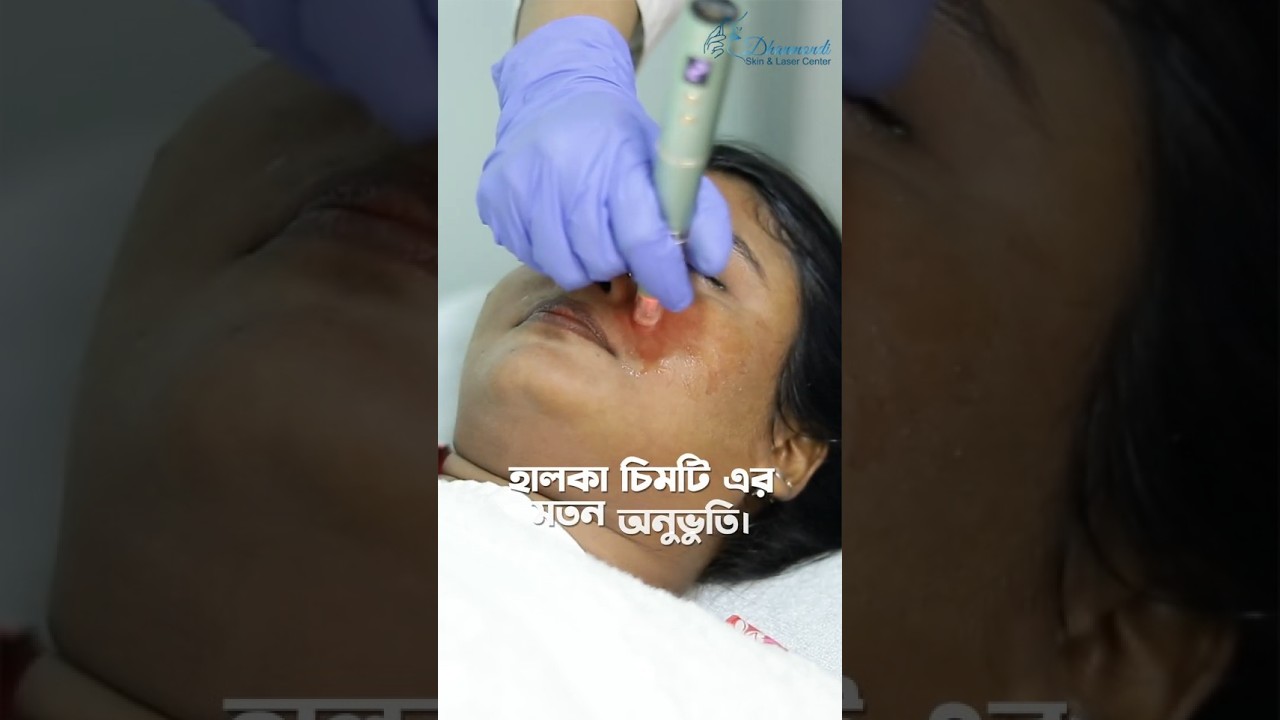 ত্বক উজ্জ্বল ও ফর্সা করতে আধুনিক চিকিৎসা!