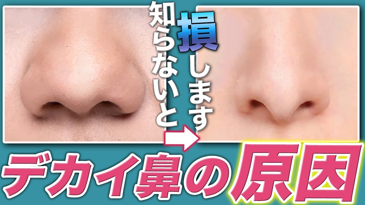 Нос Дека Нос Причина Нос Большой нос
