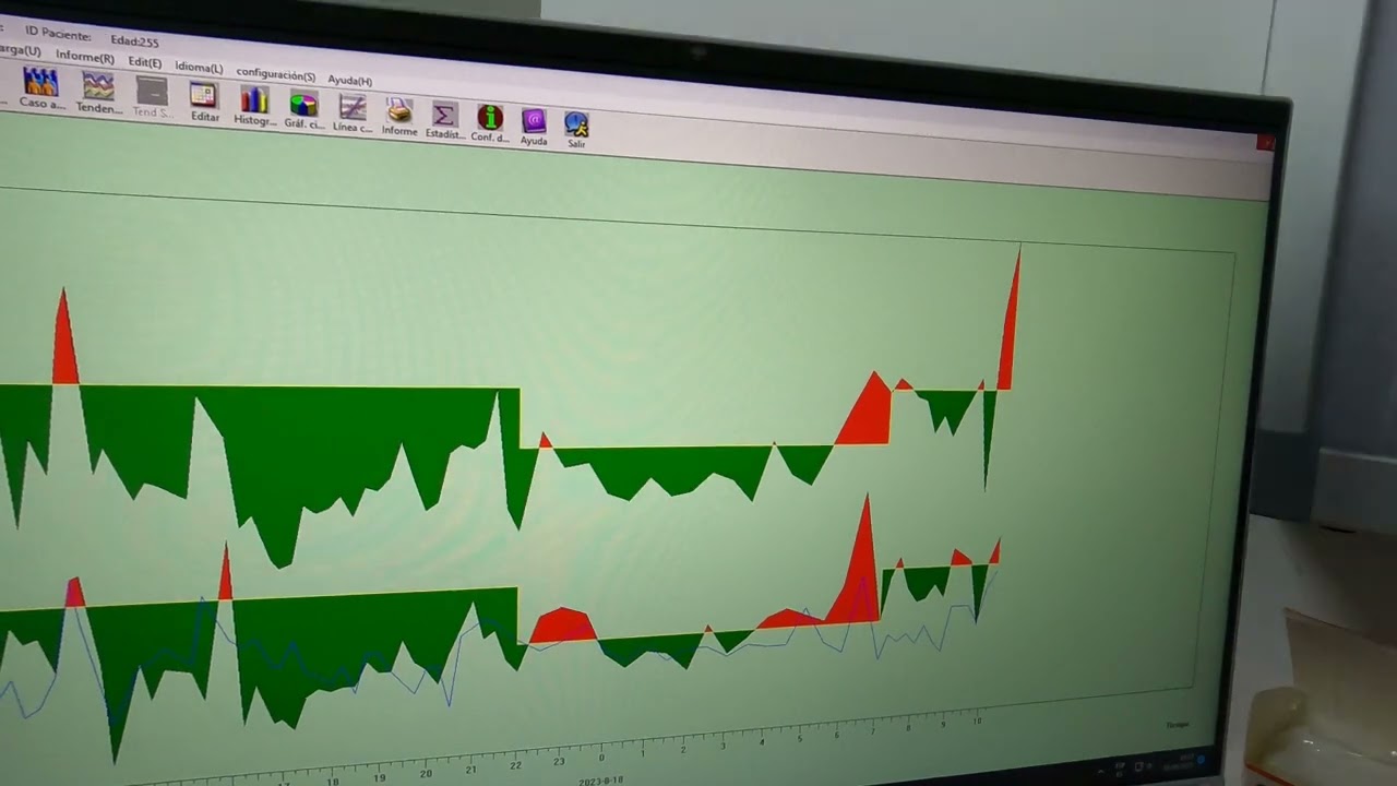 Descarga Holter de Presión Arterial - CONTEC - ABPM50