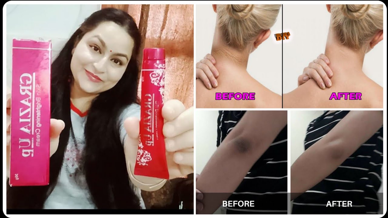 Grazia Up#Skin Brightening #Under arms#Dark Neck#Dark Knees#Elbows#For EveryOne#Review#Cream Series#