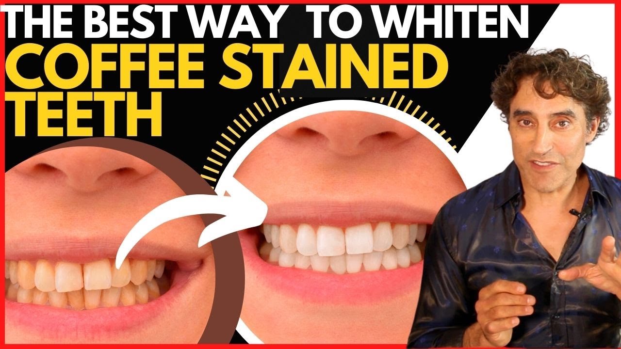 How To 🦷 AVOID COFFEE STAINING 🦷 and WHITEN YOUR TEETH // Teeth Whitening
