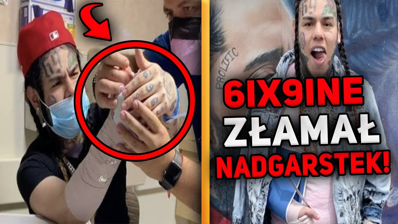 6ix9ine ZŁAMAŁ nadgarstek! Lil Durk DISSUJE 6ix9ine! Juice Wrld w FORTNITE! OsamaBluntaNews #7