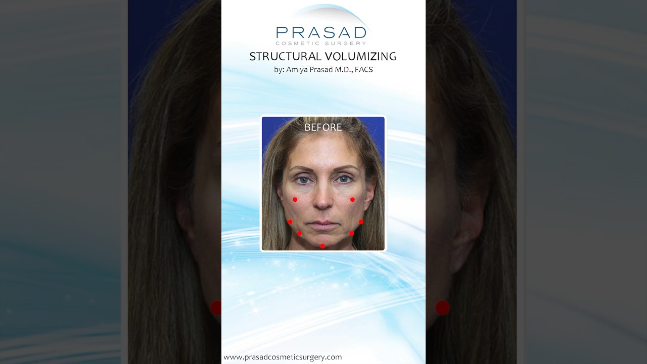Why Lasers Don't Treat the Initial Cause of Skin Laxity #facialtreatment