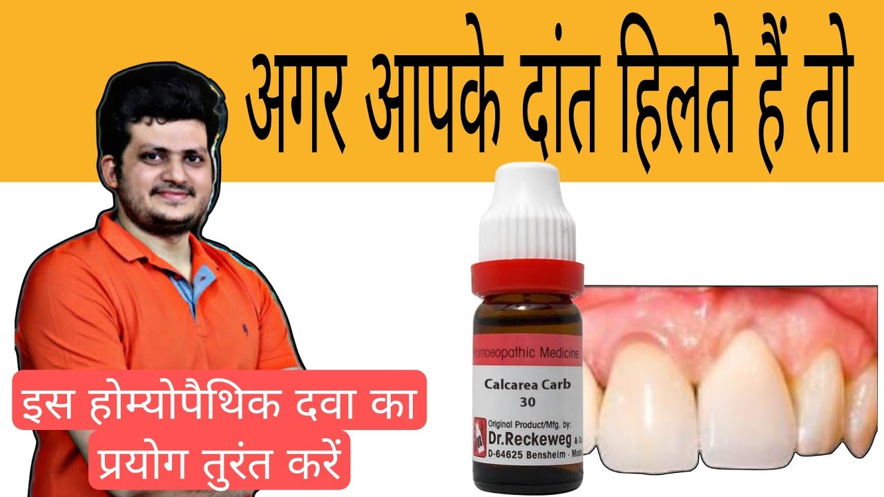 अगर आपके दांत हिलते हैं तो ? How can I strengthen weak teeth ? Homeopathic Medicine | Use |