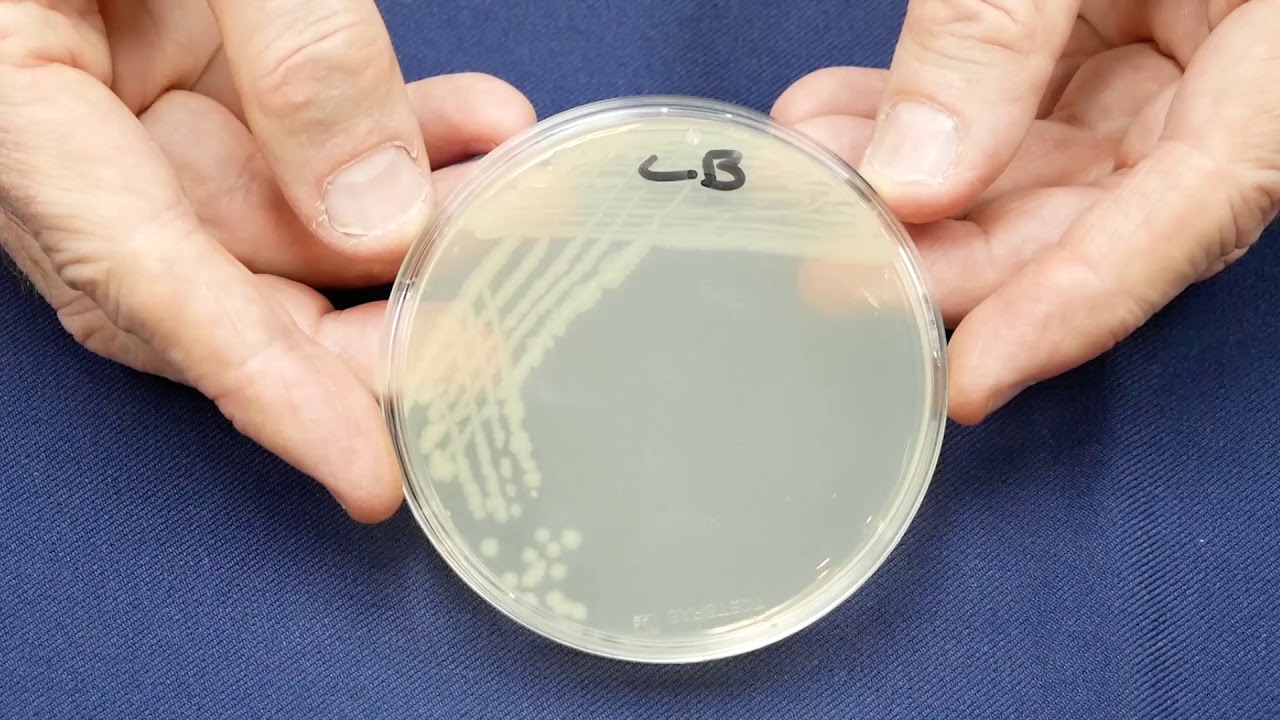 pGreen Bacterial Transformation