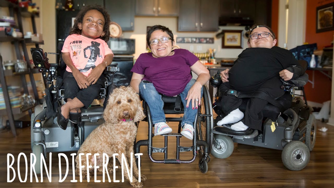 The Family &lsquo;Made Of Glass&rsquo; Have Broken 600 Bones | BORN DIFFERENT