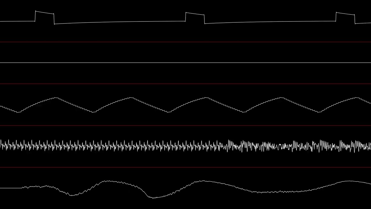 The Imp's Song (E1M2) Doom - NES cover