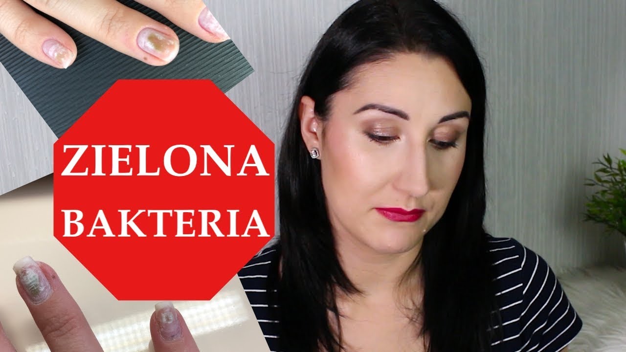 GRZYBICA PAZNOKCI gratis do żeli || zielona bakteria