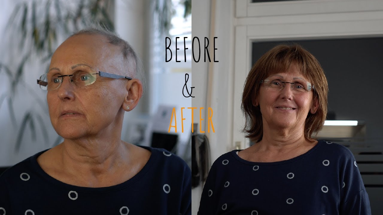 Unglaubliche Tranformation mit Echthaar Perücke | Neues Leben mit Haarystem | X-Craft