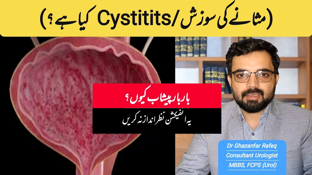 Cystitis (Urinary Infection) | Causes, Symptoms & Treatment | Dr. Ghazanfar Rafeq #cystitis #urine 