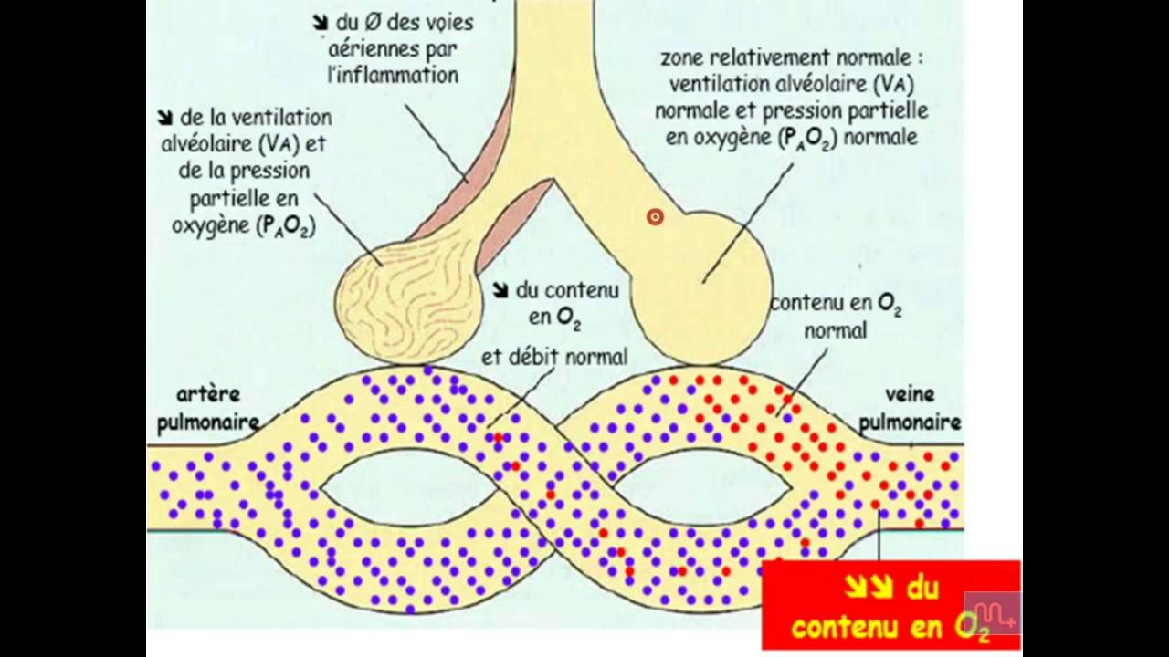 Semiologie de l'insuffisance respiratoire   Partie 1