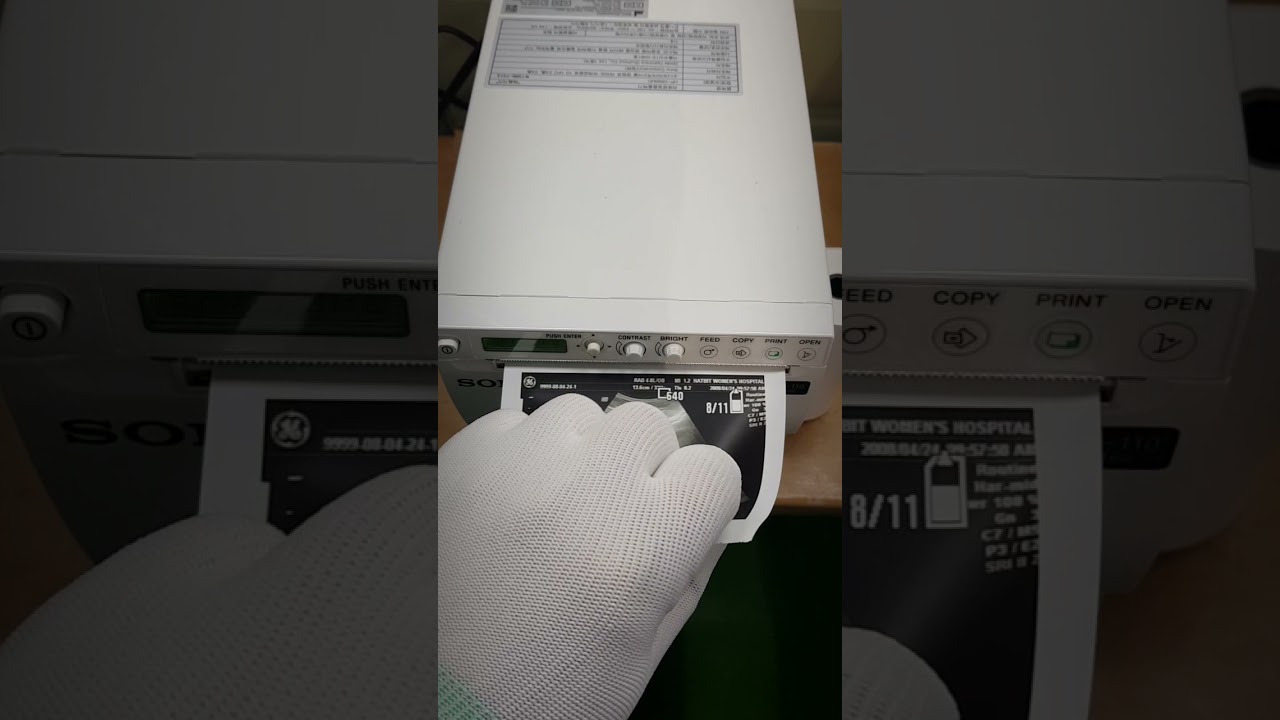 ultrasound paper,  UPP-110HD, UPP-110S, UPP-110HG