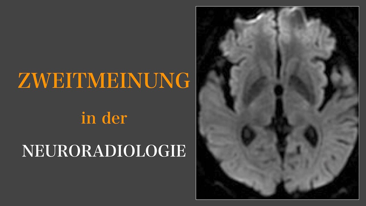 Zweitmeinung in der Neuroradiologie I Hashimoto I MS I Mikroangiopathie I Brain and Synapse