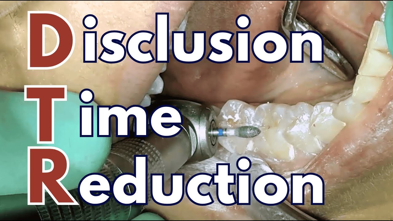 Can Occlusal Adjustment Cure TMD? 'DTR' and T-Scan Experience - PDP255